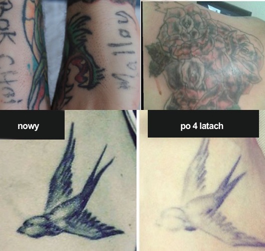 Wygląd tatuażu po 4 latach